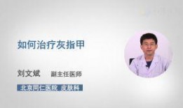 治疗灰指甲视频,跟随视频学习专业护理方法
