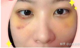去眼袋手术过程视频,专业解析与真实体验