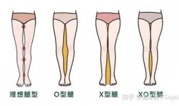 日本x型腿矫正视频,轻松掌握矫正技巧