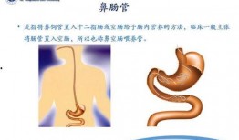 鼻肠管置入视频,鼻肠管置入操作步骤及要点解析