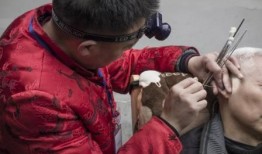 巨大耳屎视频,巨型耳屎视频引发网友热议