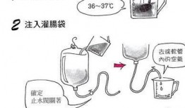 咖啡灌肠视频,养生新潮流还是健康陷阱？